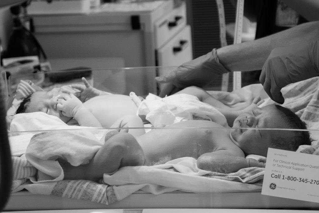 Twin Birth