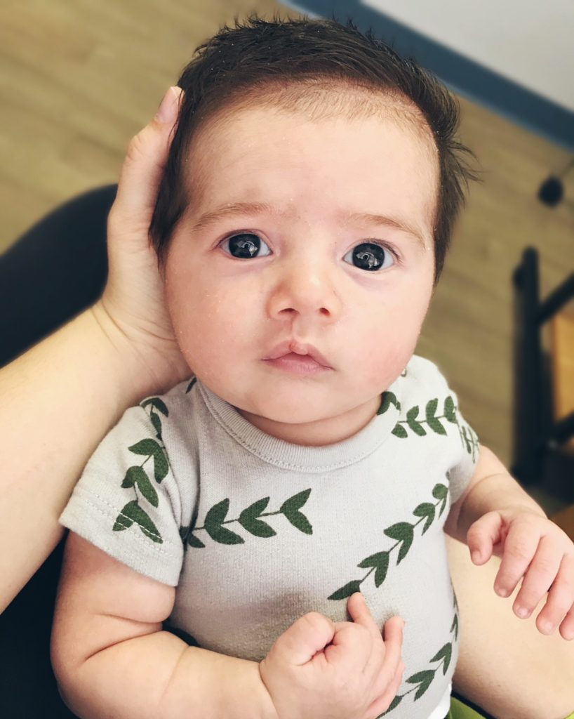 Microform Cleft Repair: Oh Happy Play a Florida Motherhood blogger shares a look at her son Beau's journey with a microform cleft lip. 