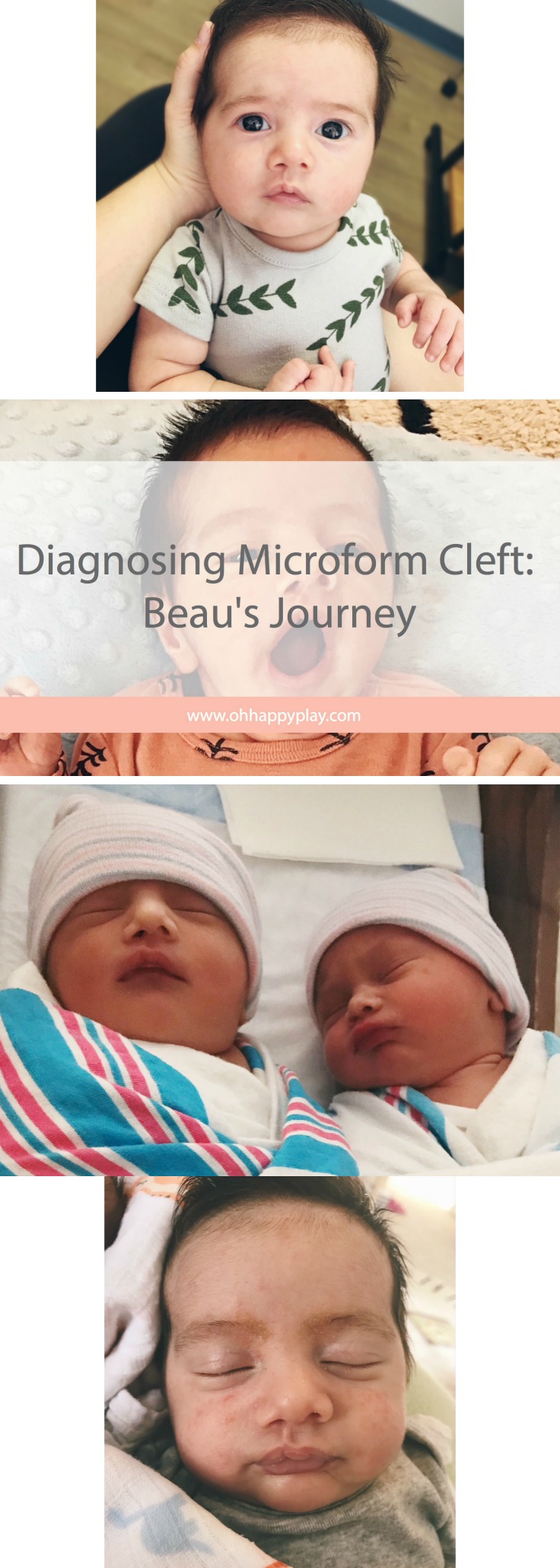 Florida Motherhood blogger, Oh Happy Play shares her journey to diagnosing Microform Cleft on her son Beau! Check it out now! 