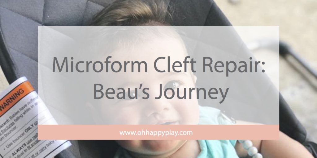 Microform Cleft Repair: Oh Happy Play a Florida Motherhood blogger shares a look at her son Beau's journey with a microform cleft lip. 